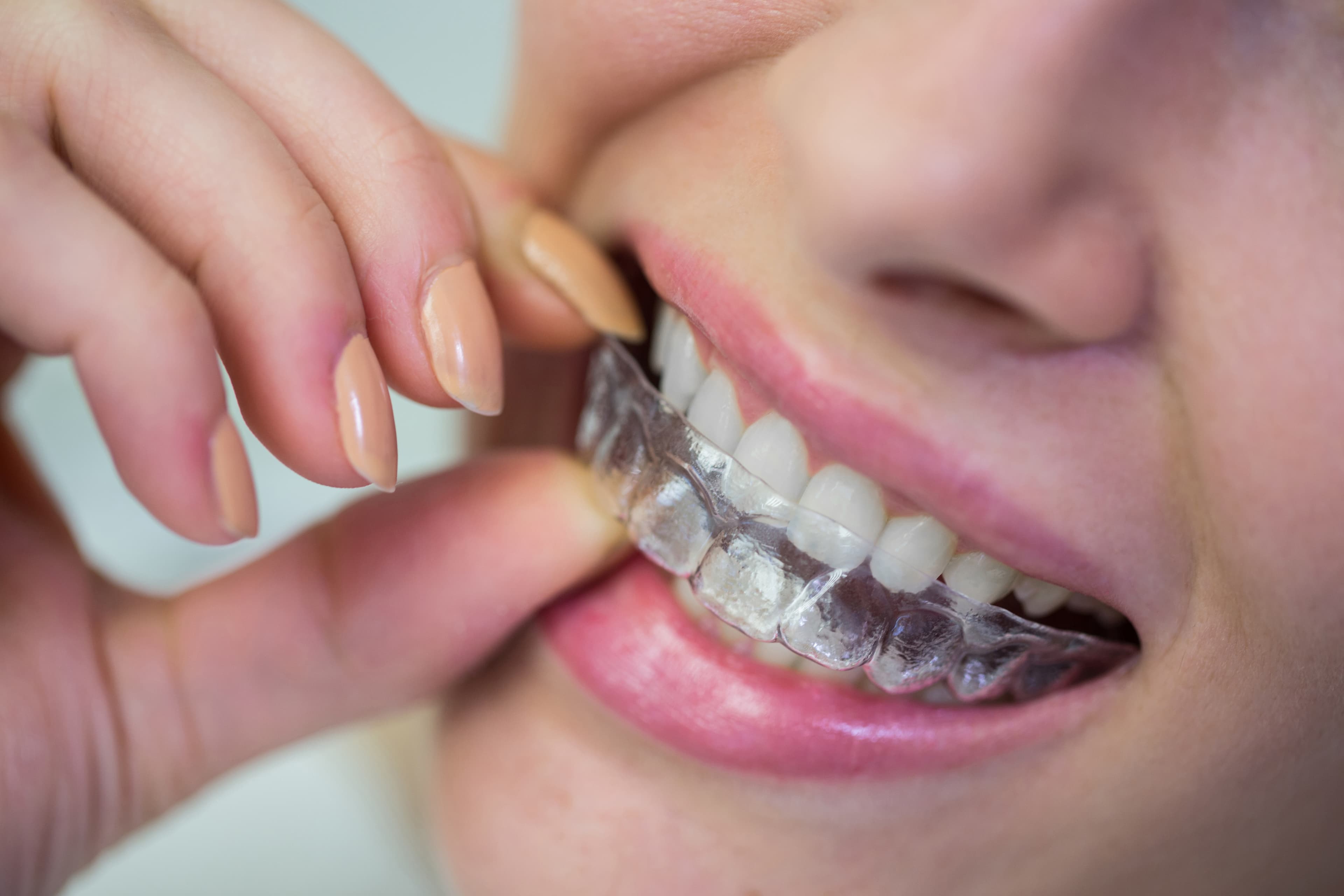 Patient smiling during a dental visit